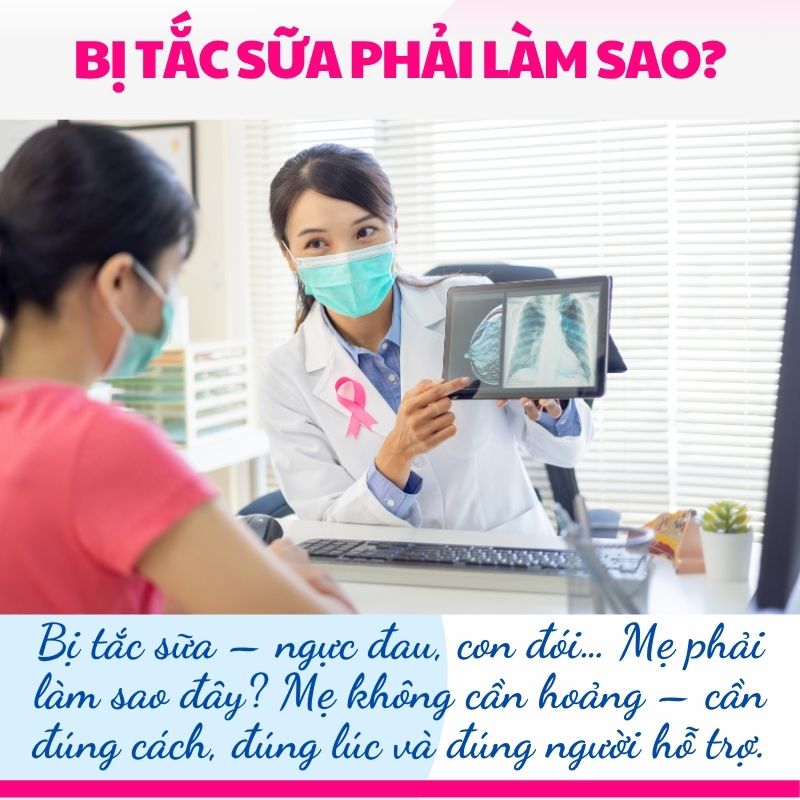 Bị tắc sữa – ngực đau, con đói… Mẹ phải làm sao đây? Mẹ không cần hoảng – cần đúng cách, đúng lúc và đúng người hỗ trợ.